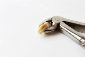 Wisdom tooth