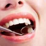 Teeth Filling vs Root Canal: Which One Do You Really Need?